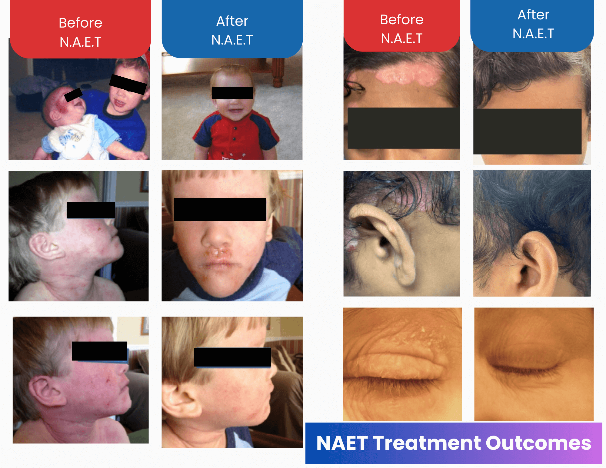 Autism Treatment For Children