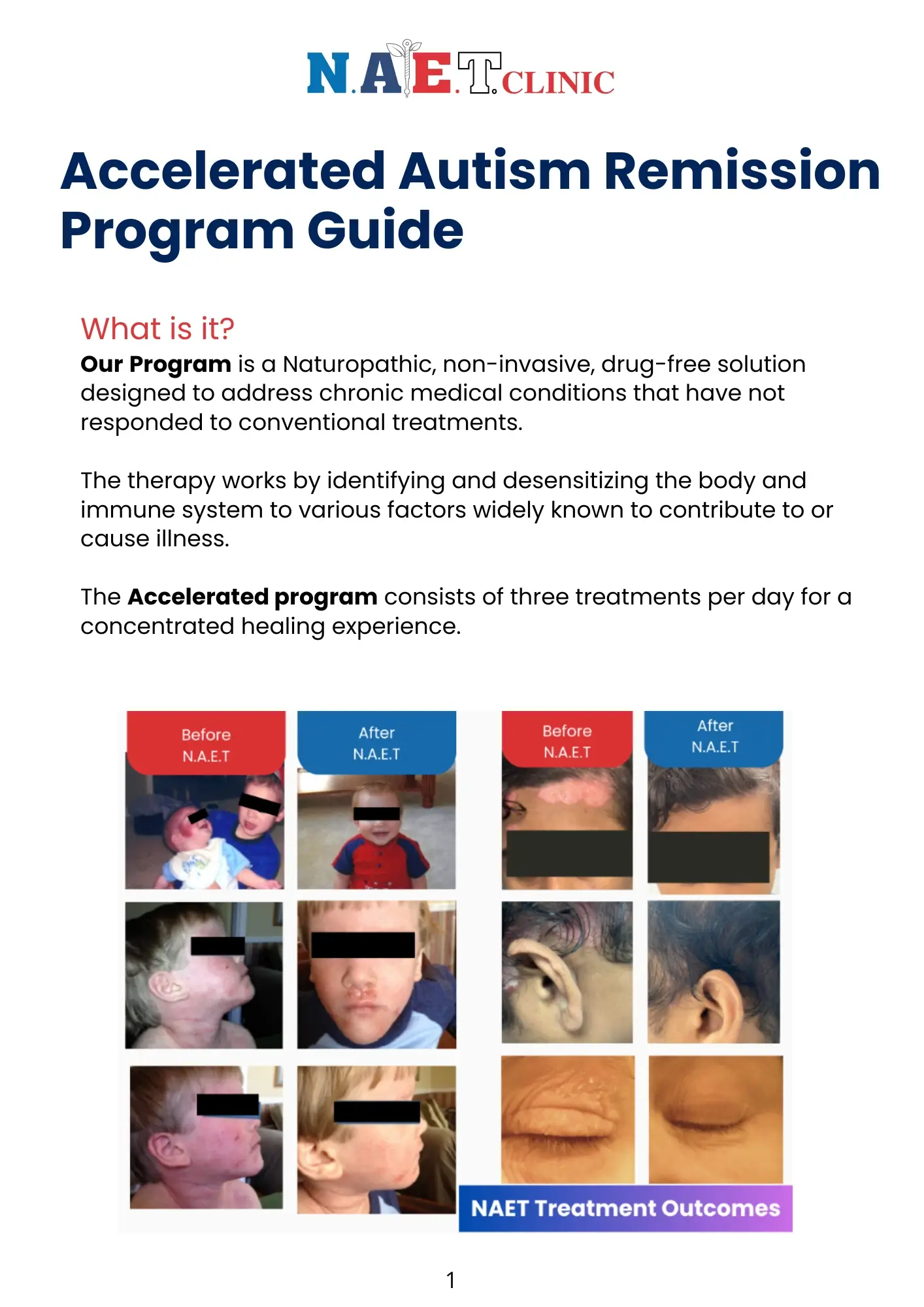 Free Accelerated Guide